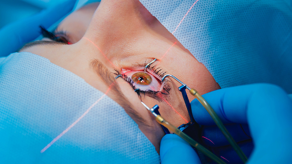 Nutrisi Penanganan Cegah Katarak